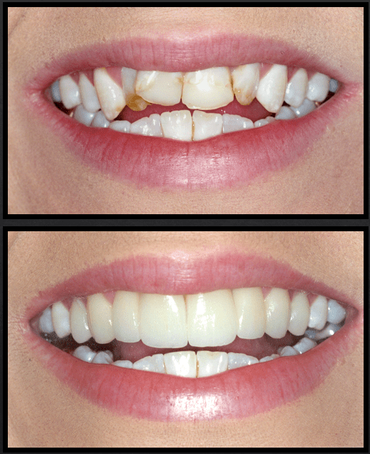 Cosmetic Dentist In Plemons Eakle Amarillo Texas TX
