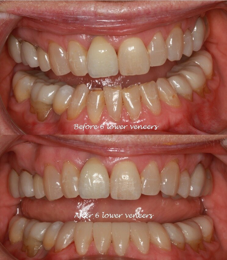 Cosmetic Dentist In Plemons Eakle Amarillo Texas TX