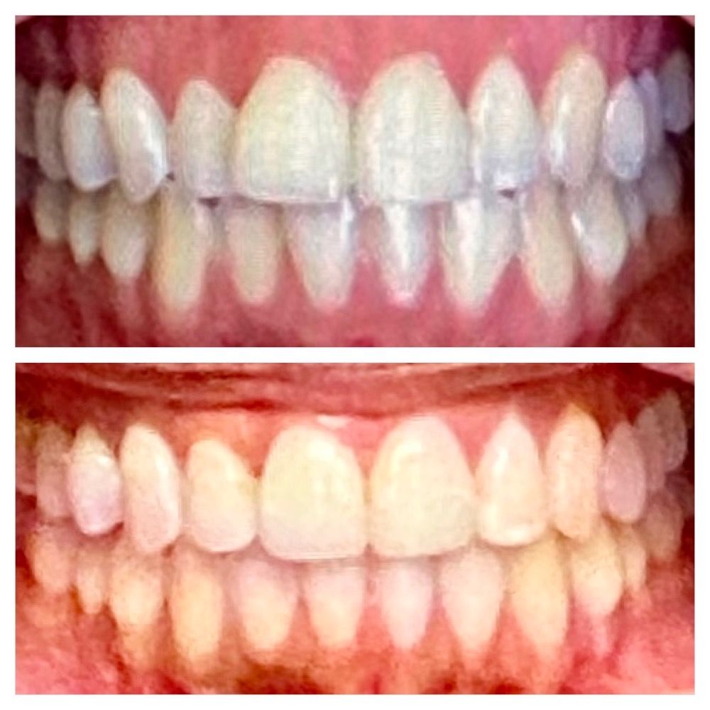 Cosmetic Dentist In Point Richmond California Calif CA
