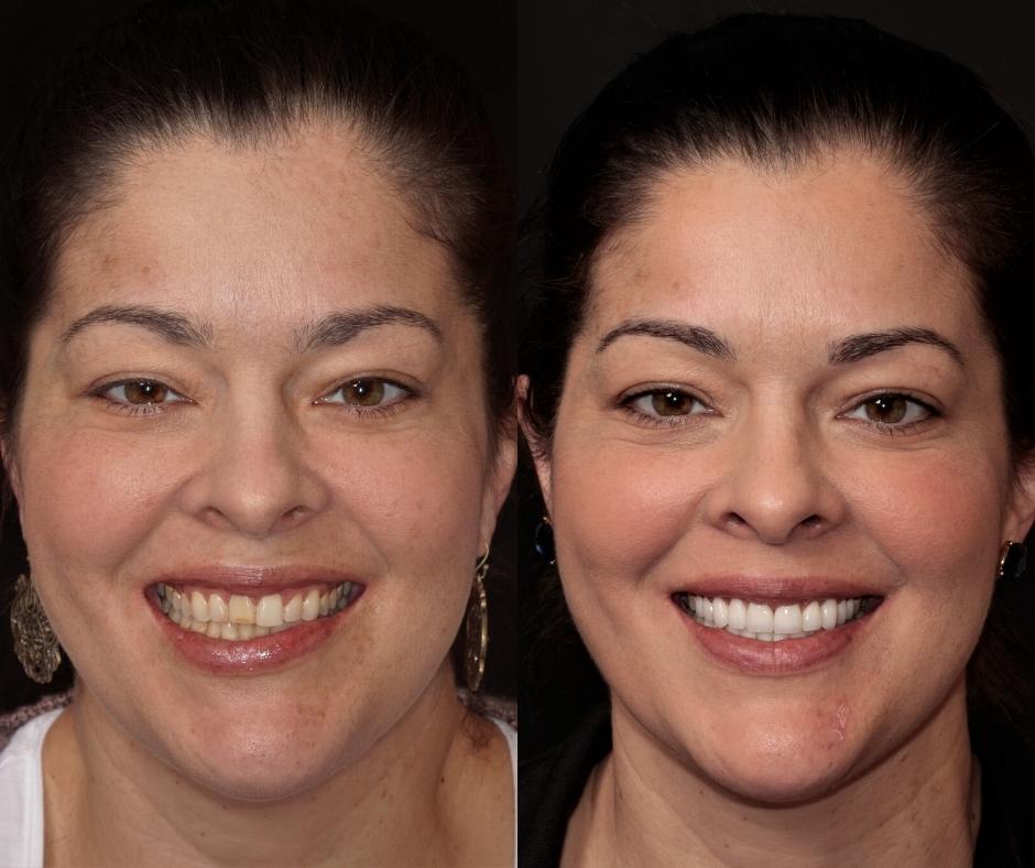 Cosmetic Dentist In Portola Springs Irvine California Calif CA Cosmetic Dentist In Portola Springs Irvine California Calif CA