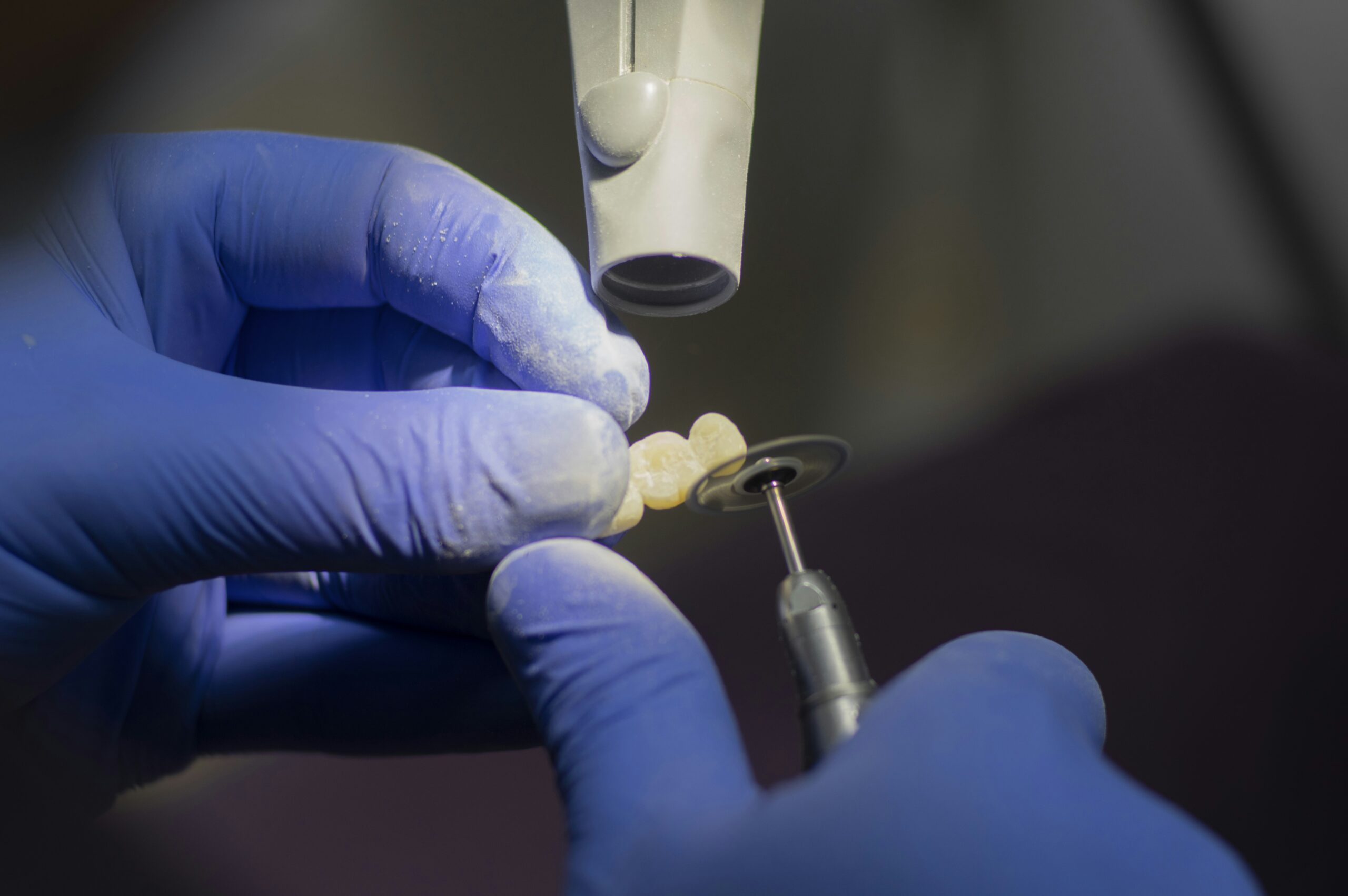 Cosmetic Dentist In Quartz Hill Adjacent To Palmdale California Calif CA