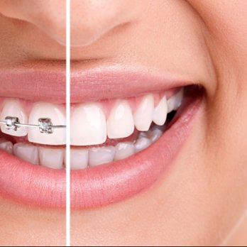 Cosmetic Dentist In Rancho Del Oro Oceanside California Calif CA