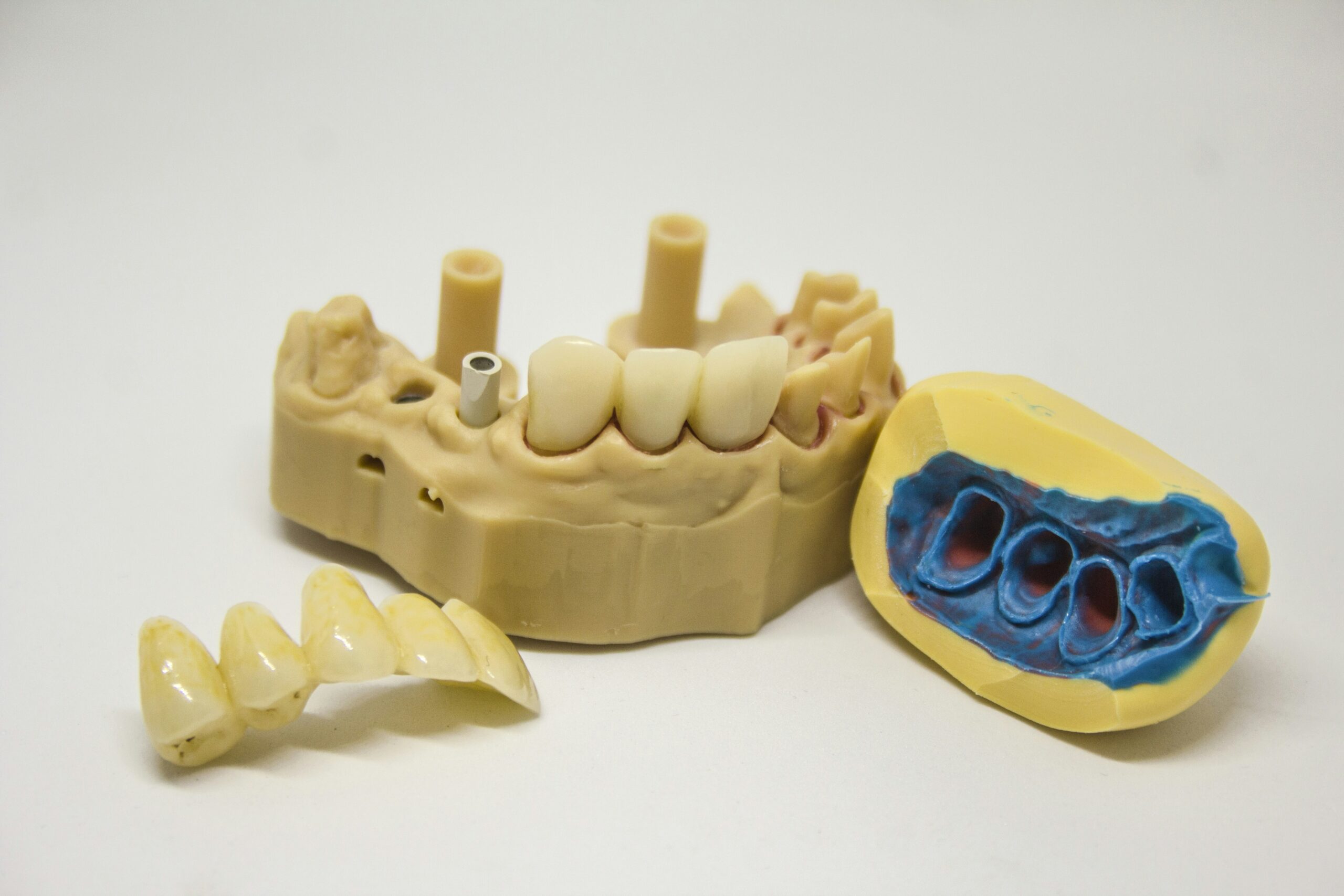 Cosmetic Dentist In Rhodes Ranch Las Vegas Nevada Nev NV Cosmetic Dentist In Rhodes Ranch Las Vegas Nevada Nev NV