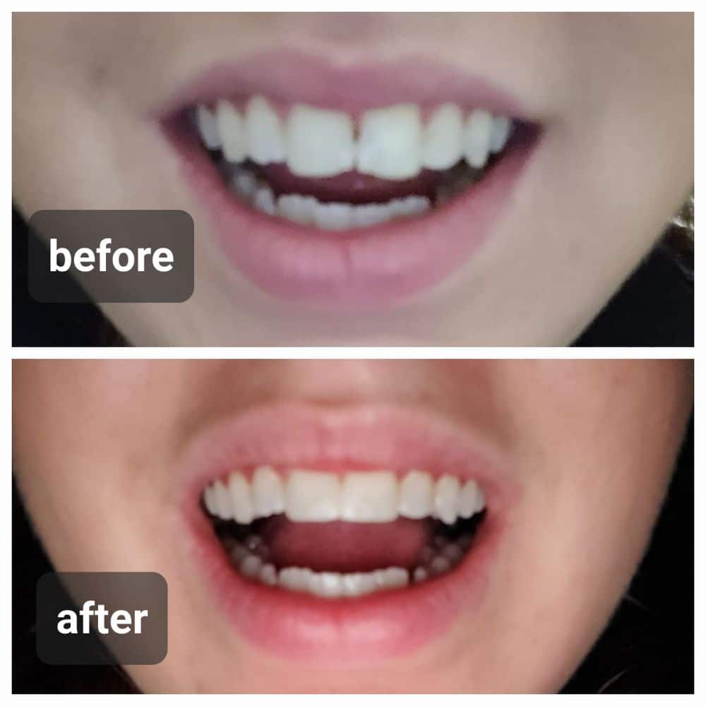Cosmetic Dentist In Ridgeland Adjacent To Jackson Mississippi Miss MS Cosmetic Dentist In Ridgeland Adjacent To Jackson Mississippi Miss MS