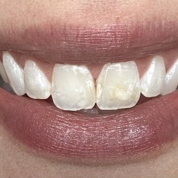 Cosmetic Dentist In RiNo River North Denver Colorado Colo CO