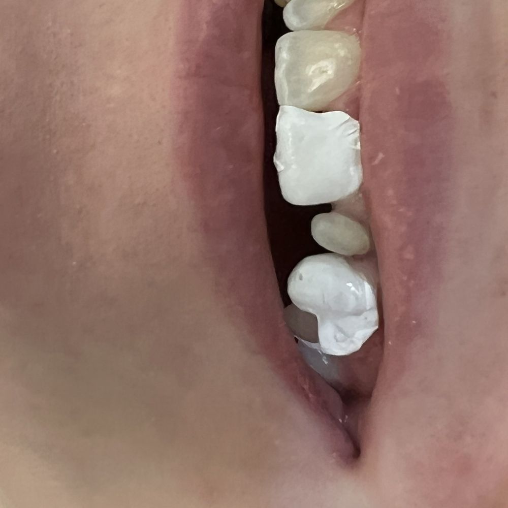 Cosmetic Dentist In Rose Park Salt Lake City Utah UT Cosmetic Dentist In Rose Park Salt Lake City Utah UT