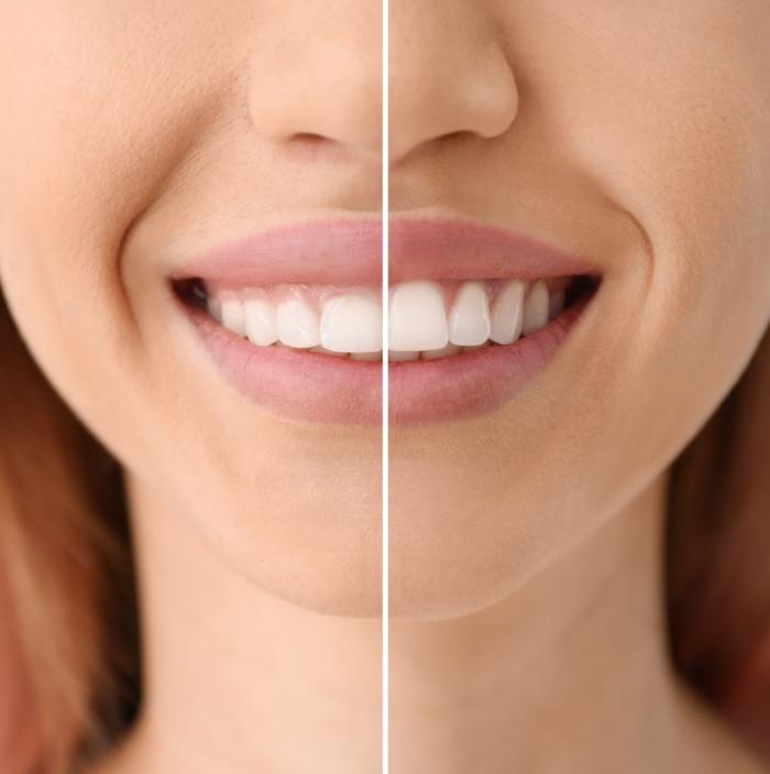 Cosmetic Dentist In Shea Corridor Scottsdale Arizona Ariz AZ Cosmetic Dentist In Shea Corridor Scottsdale Arizona Ariz AZ