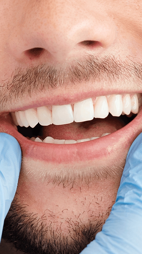 Cosmetic Dentist In Signal Hill Adjacent To Long Beach California Calif CA Cosmetic Dentist In Signal Hill Adjacent To Long Beach California Calif CA