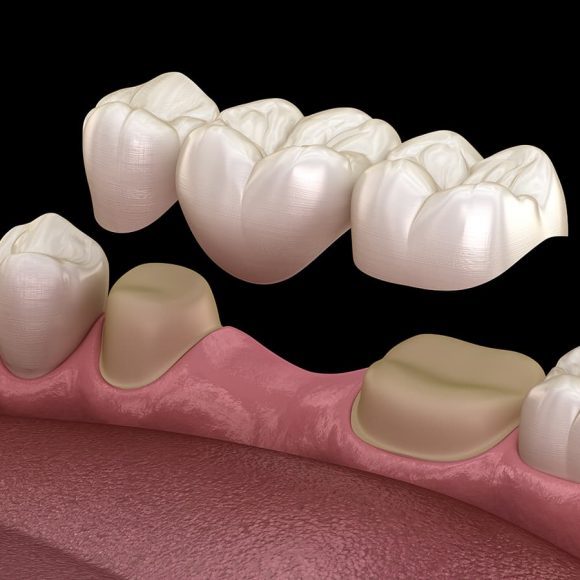 Cosmetic Dentist In Sol Vista Westminster California CA