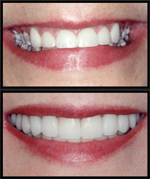 Cosmetic Dentist In Soncy Adjacent To Amarillo Texas TX