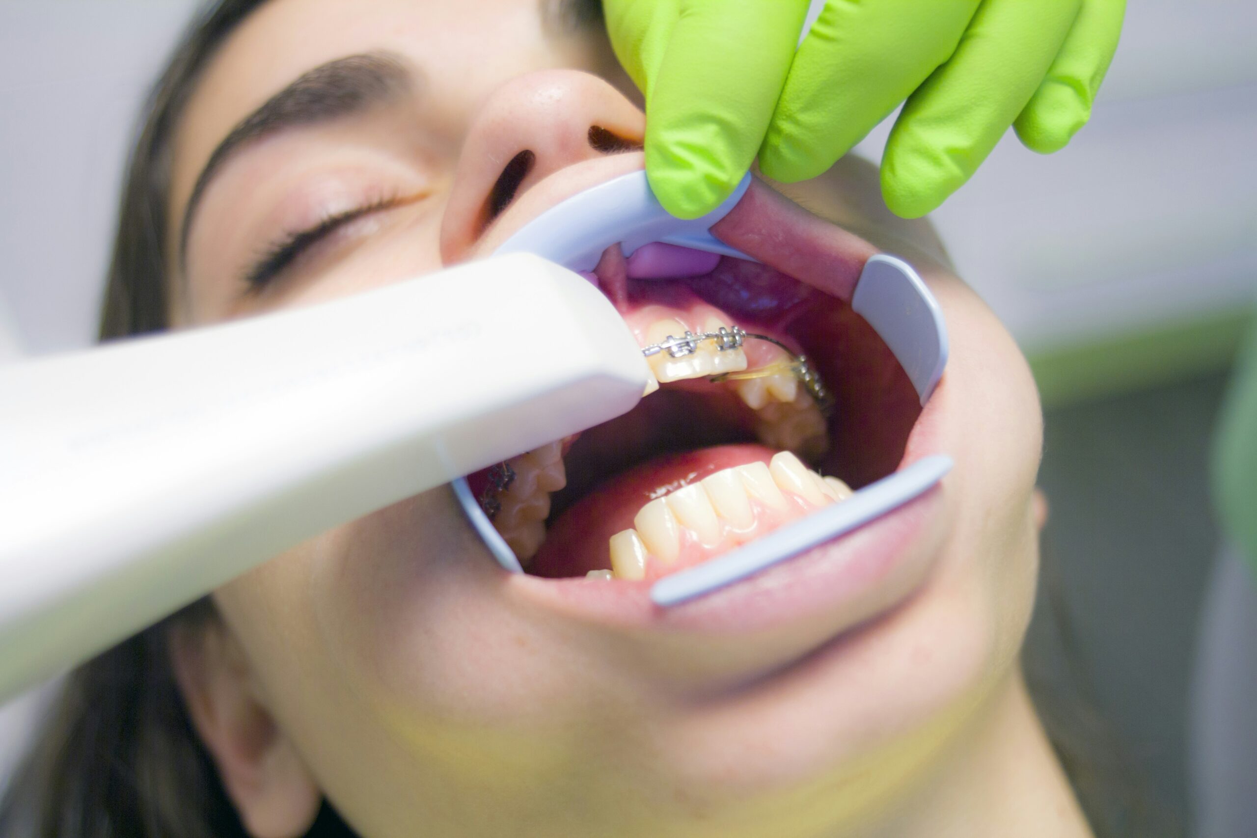Cosmetic Dentist In South Hill Spokane Washington Wash WA