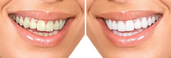 Cosmetic Dentist In Monroe Louisiana 2 Cosmetic Dentist In Monroe Louisiana