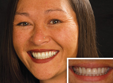 Cosmetic Dentist In South Oceanside California Calif CA Cosmetic Dentist In South Oceanside California Calif CA