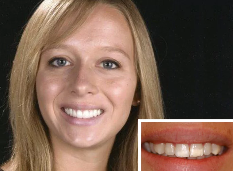 Cosmetic Dentist In South Oceanside California Calif CA Cosmetic Dentist In South Oceanside California Calif CA