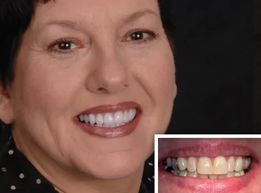 Cosmetic Dentist In South Oceanside California Calif CA Cosmetic Dentist In South Oceanside California Calif CA