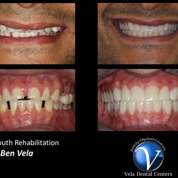 Cosmetic Dentist In Southside Corpus Christi Texas TX