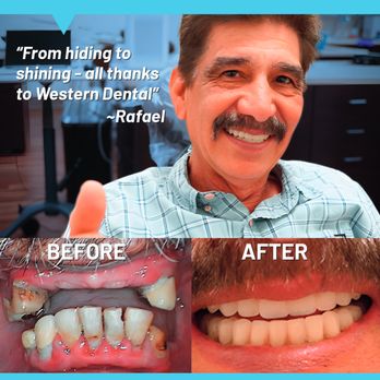 Cosmetic Dentist In Standiford Modesto California Calif CA Cosmetic Dentist In Standiford Modesto California Calif CA