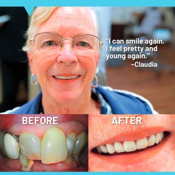 Cosmetic Dentist In Standiford Modesto California Calif CA Cosmetic Dentist In Standiford Modesto California Calif CA