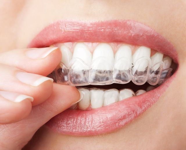 Cosmetic Dentist In Starmount Greensboro North Carolina NC Cosmetic Dentist In Starmount Greensboro North Carolina NC
