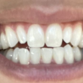 Cosmetic Dentist In Sunbow Chula Vista California Calif CA Cosmetic Dentist In Sunbow Chula Vista California Calif CA