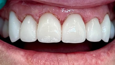 Cosmetic Dentist In The Avenues Salt Lake City Utah UT Cosmetic Dentist In The Avenues Salt Lake City Utah UT