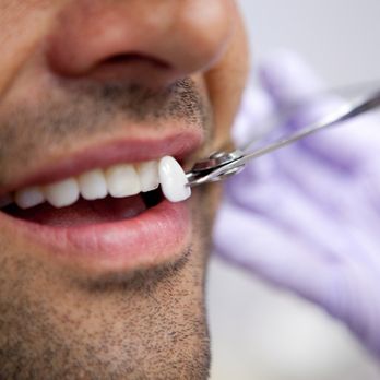 Cosmetic Dentist In The Gulch Nashville Tennessee Tenn TN Cosmetic Dentist In The Gulch Nashville Tennessee Tenn TN