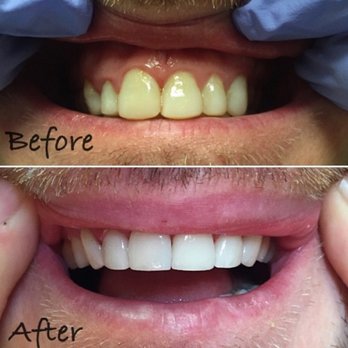 Cosmetic Dentist In The Gulch Nashville Tennessee Tenn TN Cosmetic Dentist In The Gulch Nashville Tennessee Tenn TN