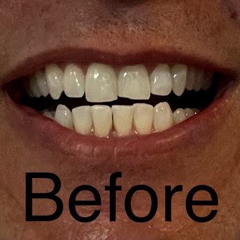 Cosmetic Dentist In Thornton Park Orlando Florida Fla FL Cosmetic Dentist In Thornton Park Orlando Florida Fla FL