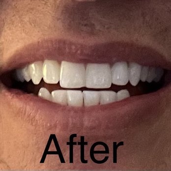 Cosmetic Dentist In Thornton Park Orlando Florida Fla FL Cosmetic Dentist In Thornton Park Orlando Florida Fla FL