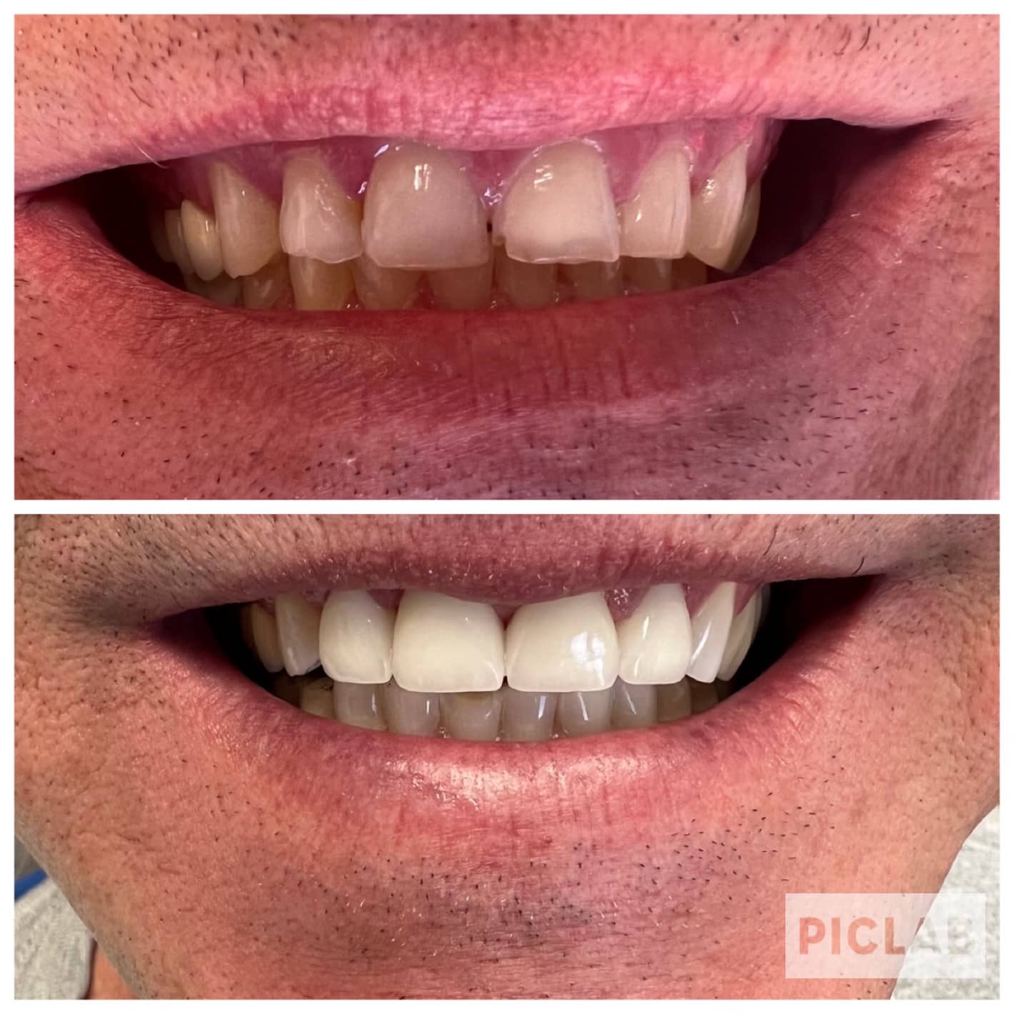 Cosmetic Dentist In Uptown Denver Colorado Colo CO