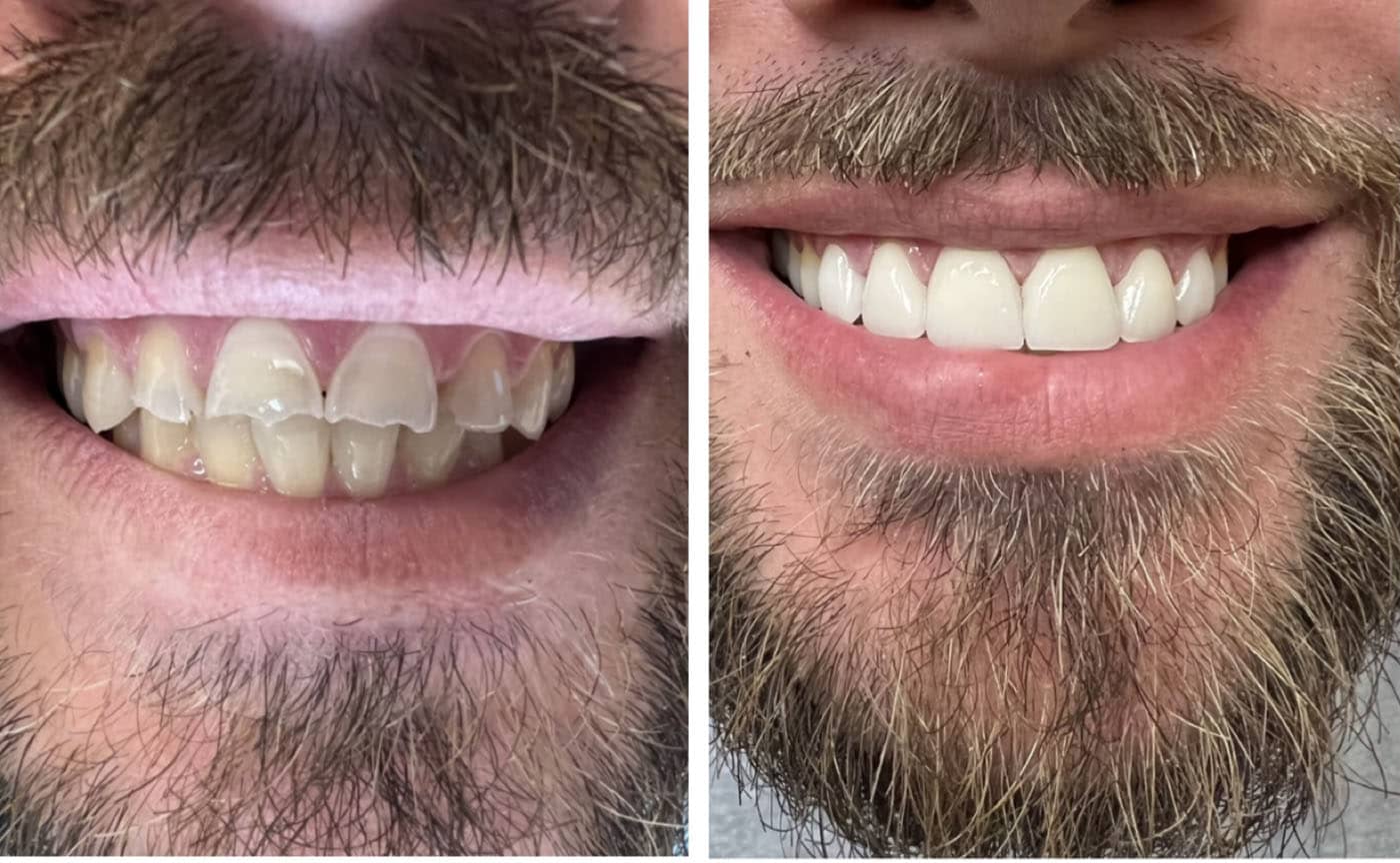 Cosmetic Dentist In Uptown Denver Colorado Colo CO