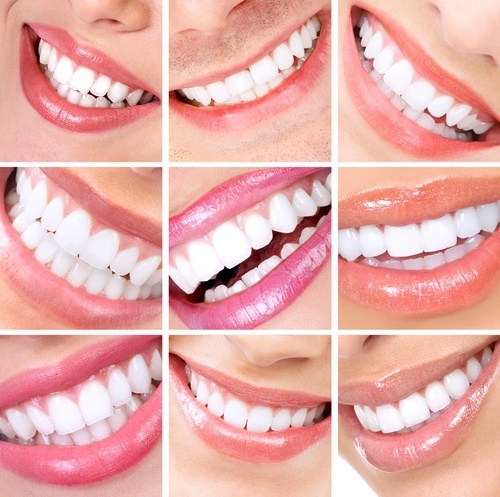 Cosmetic Dentist In Verdi Adjacent To Reno Nevada Nev NV Cosmetic Dentist In Verdi Adjacent To Reno Nevada Nev NV