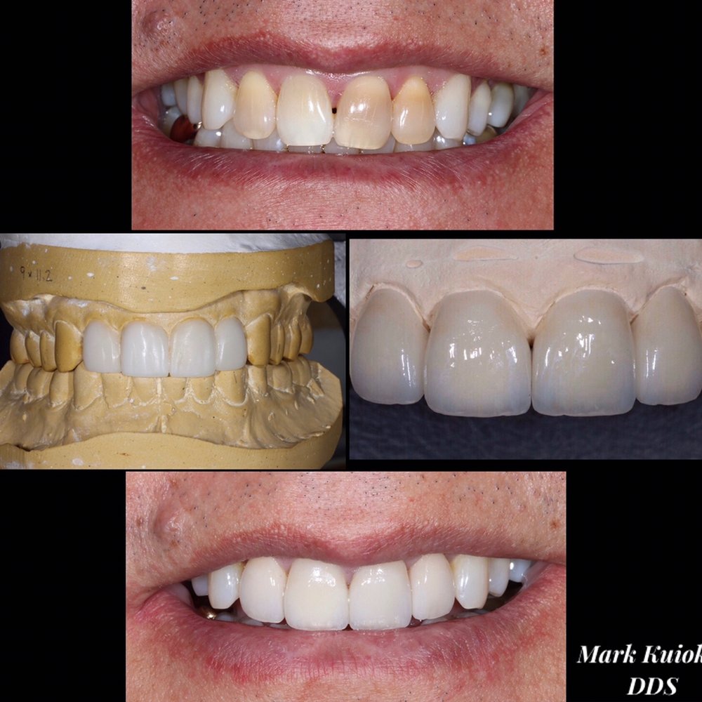 Cosmetic Dentist In Waikiki Honolulu Hawaii HI Cosmetic Dentist In Waikiki Honolulu Hawaii HI