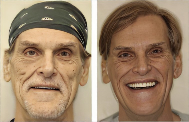 Cosmetic Dentist In Walkers Point Milwaukee Wisconsin Wis WI Cosmetic Dentist In Walkers Point Milwaukee Wisconsin Wis WI
