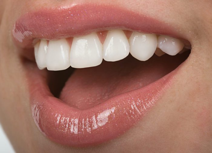 Cosmetic Dentist In West Fullerton Fullerton California Calif CA