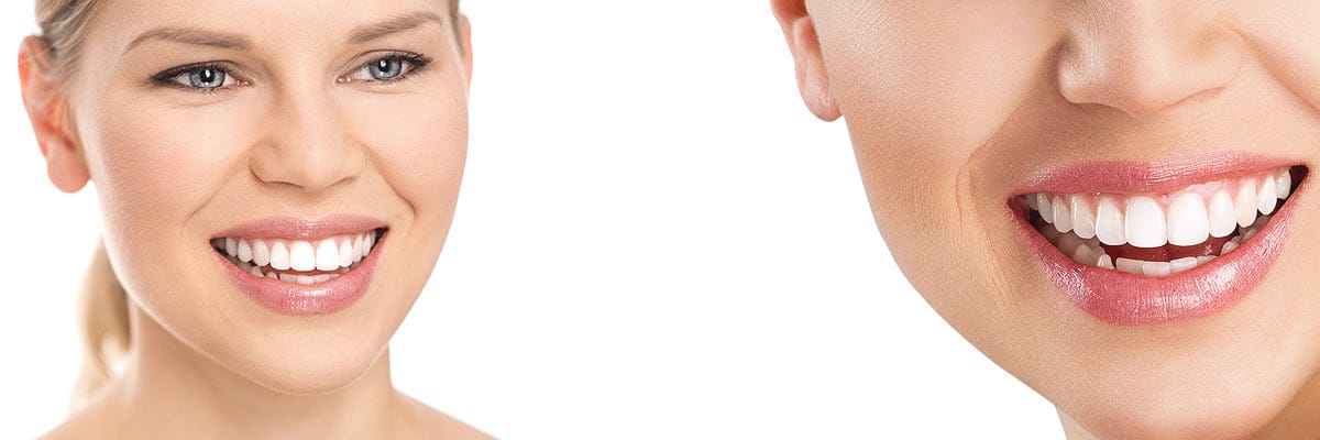 Cosmetic Dentist In West Fullerton Fullerton California Calif CA