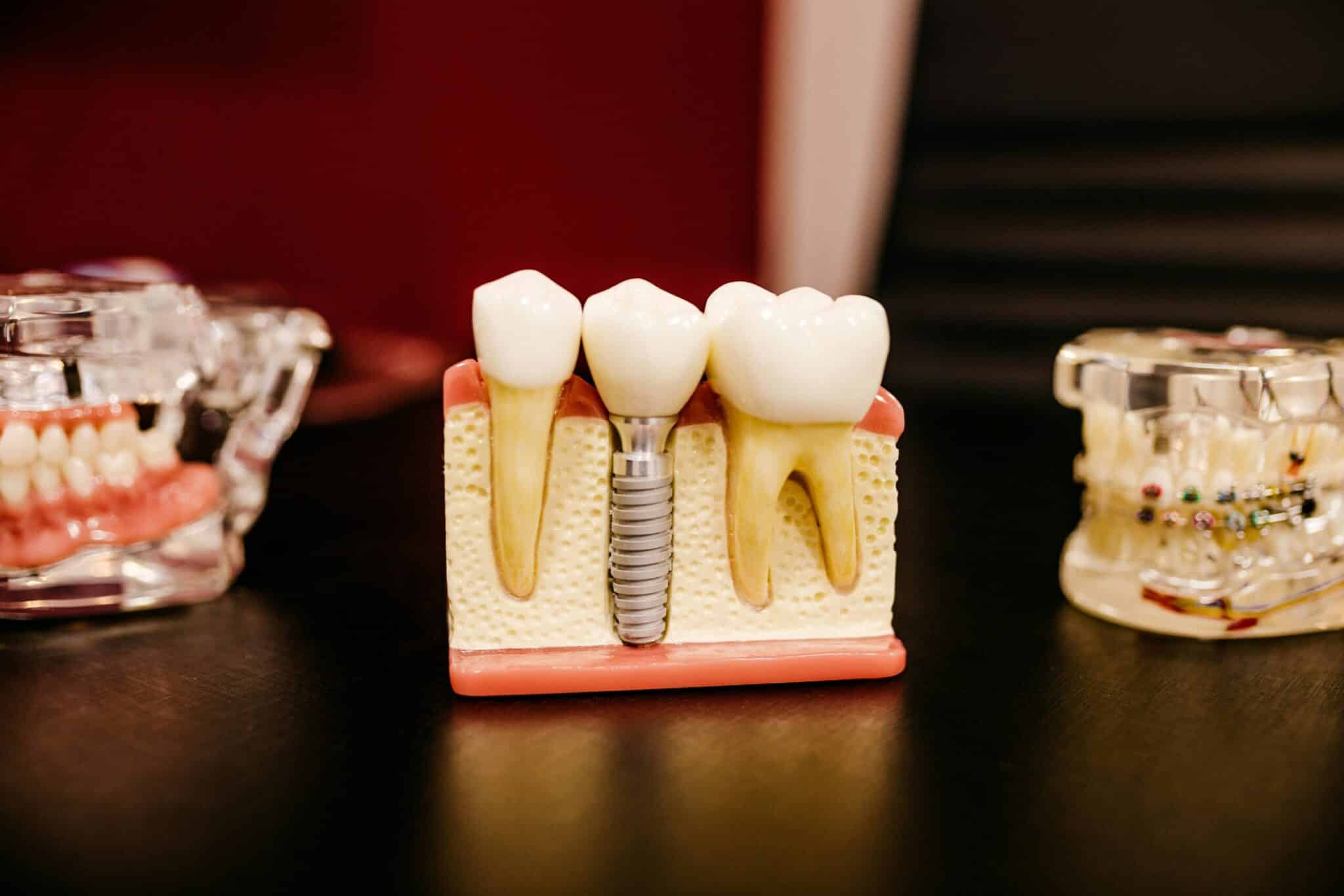 Cosmetic Dentist In West Pines Pembroke Pines Florida Fla FL