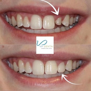 Cosmetic Dentist In West Raleigh North Carolina NC