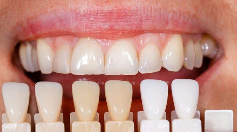 Cosmetic Dentist In West Side Manchester New Hampshire NH