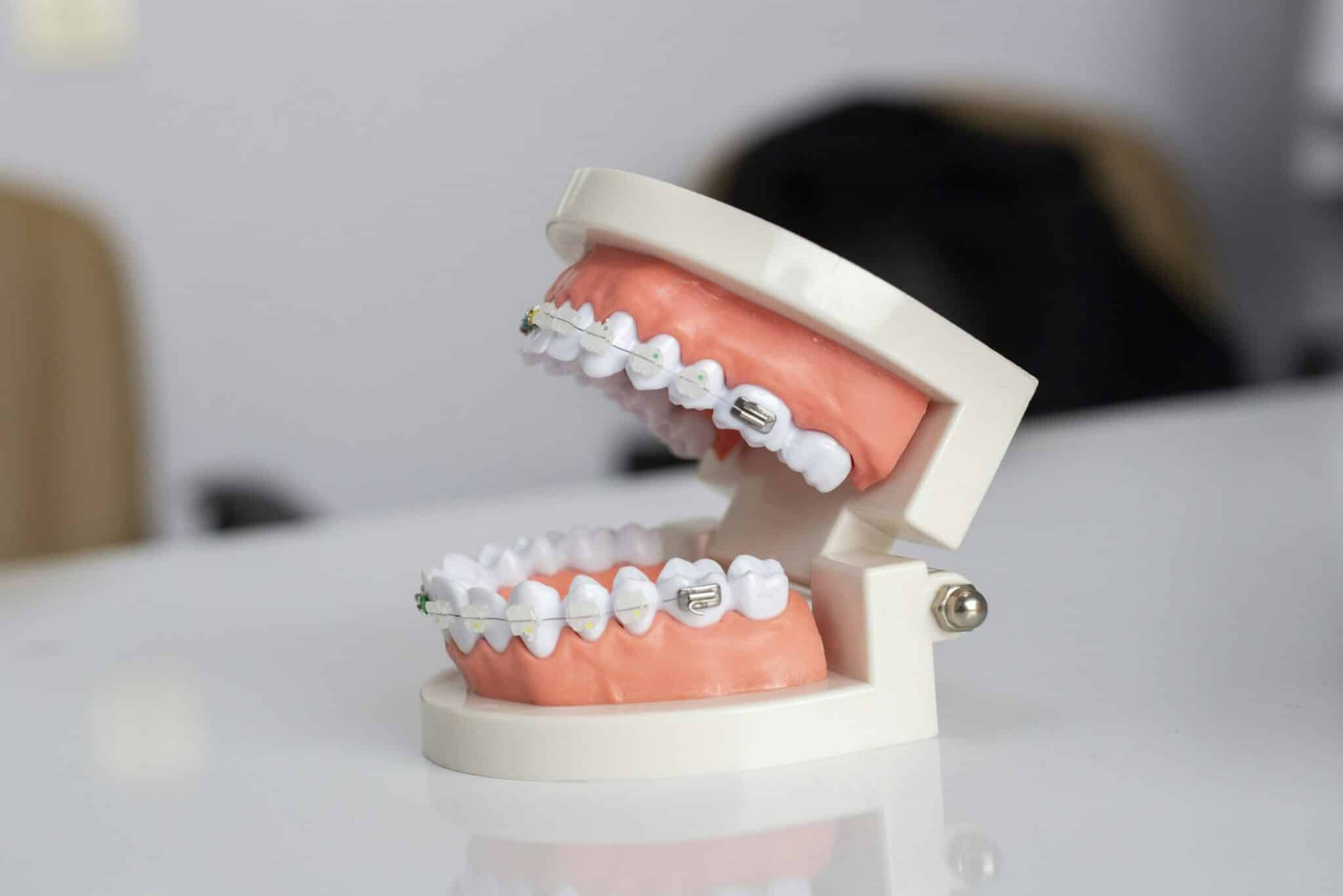 Cosmetic Dentist In West Sioux Falls Sioux Falls South Dakota SD Cosmetic Dentist In West Sioux Falls Sioux Falls South Dakota SD