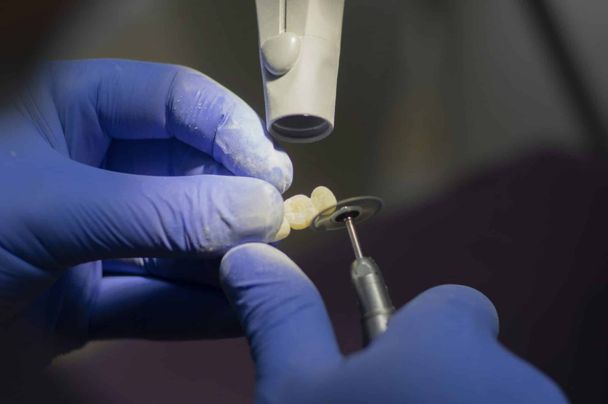 Cosmetic Dentist In West Sioux Falls Sioux Falls South Dakota SD Cosmetic Dentist In West Sioux Falls Sioux Falls South Dakota SD