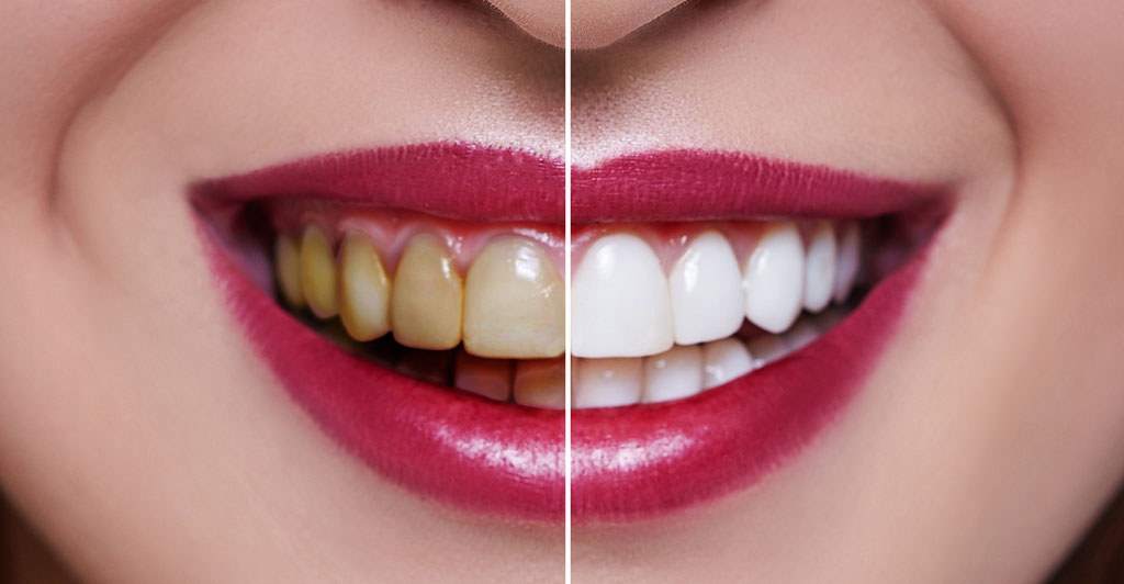 Cosmetic Dentist In Westerwood Greensboro North Carolina NC Cosmetic Dentist In Westerwood Greensboro North Carolina NC