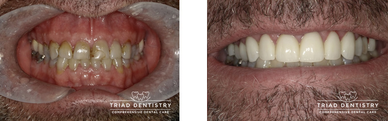 Cosmetic Dentist In Westerwood Greensboro North Carolina NC Cosmetic Dentist In Westerwood Greensboro North Carolina NC