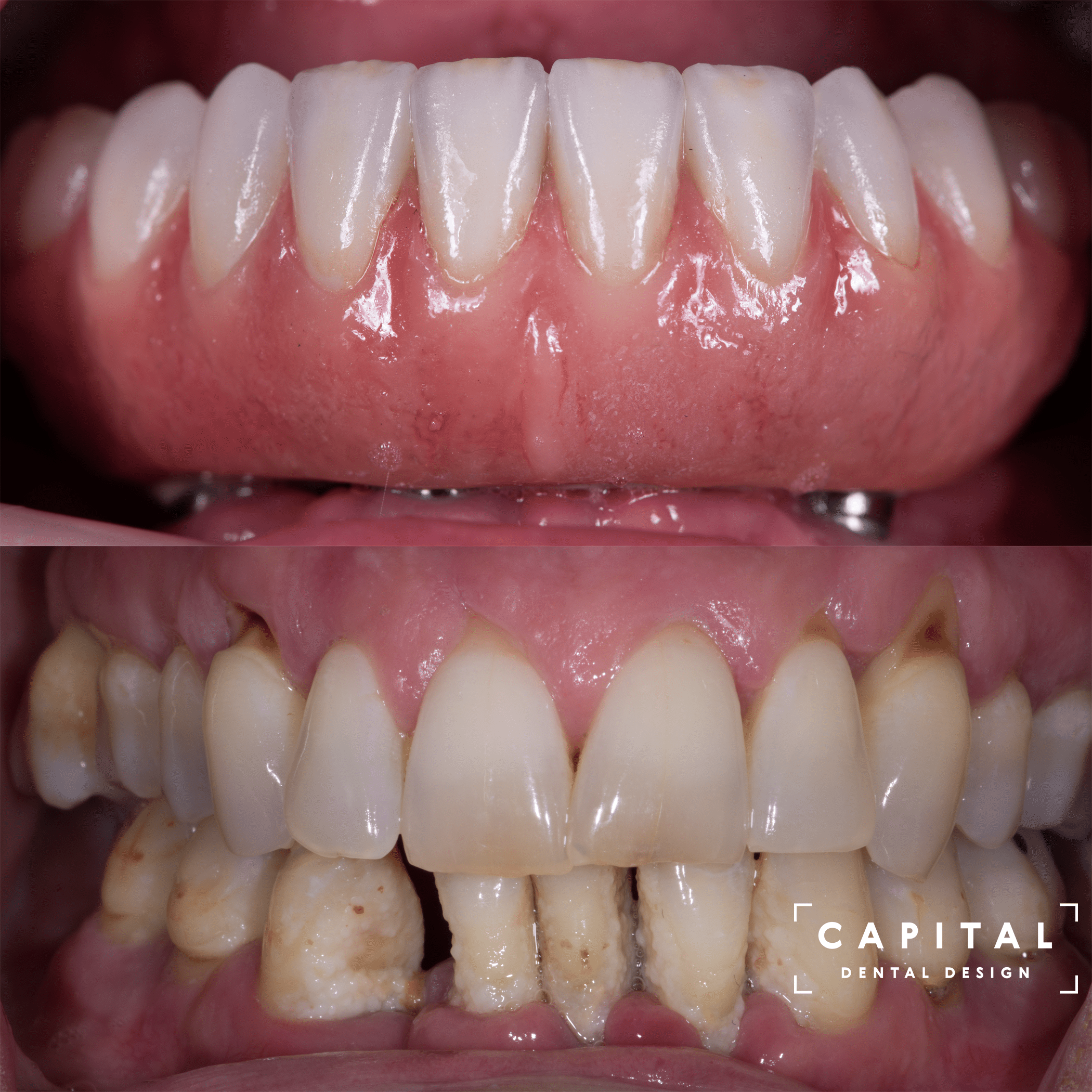 Cosmetic Dentist In Westover Hills Richmond Virginia VA