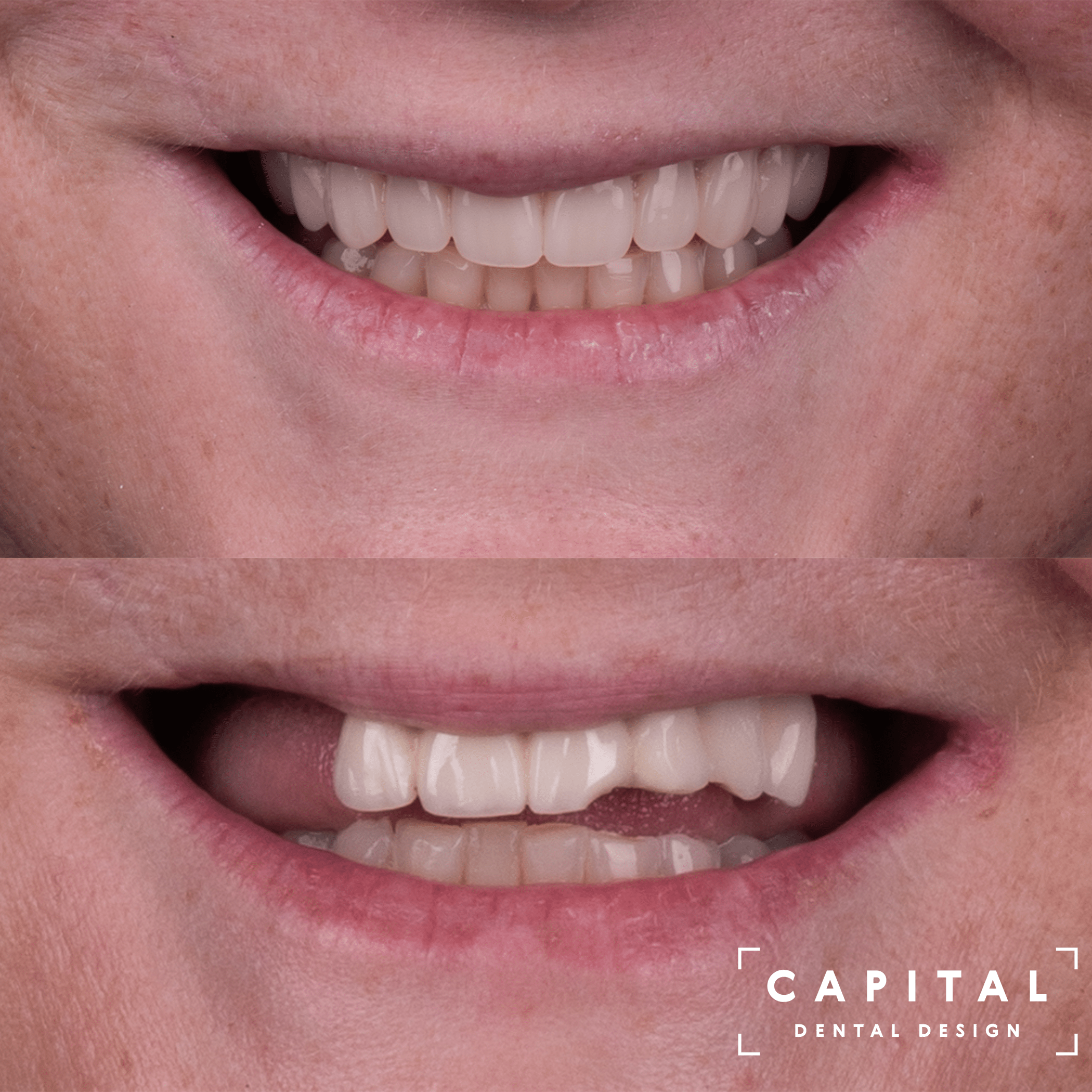 Cosmetic Dentist In Westover Hills Richmond Virginia VA