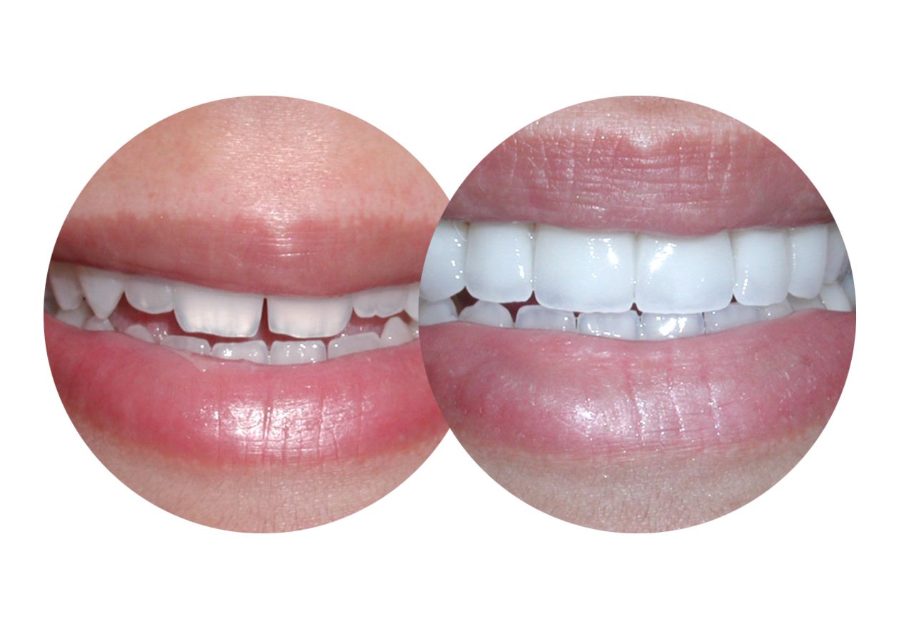 Cosmetic Dentist In Westpark Bakersfield California Calif CA Cosmetic Dentist In Westpark Bakersfield California Calif CA