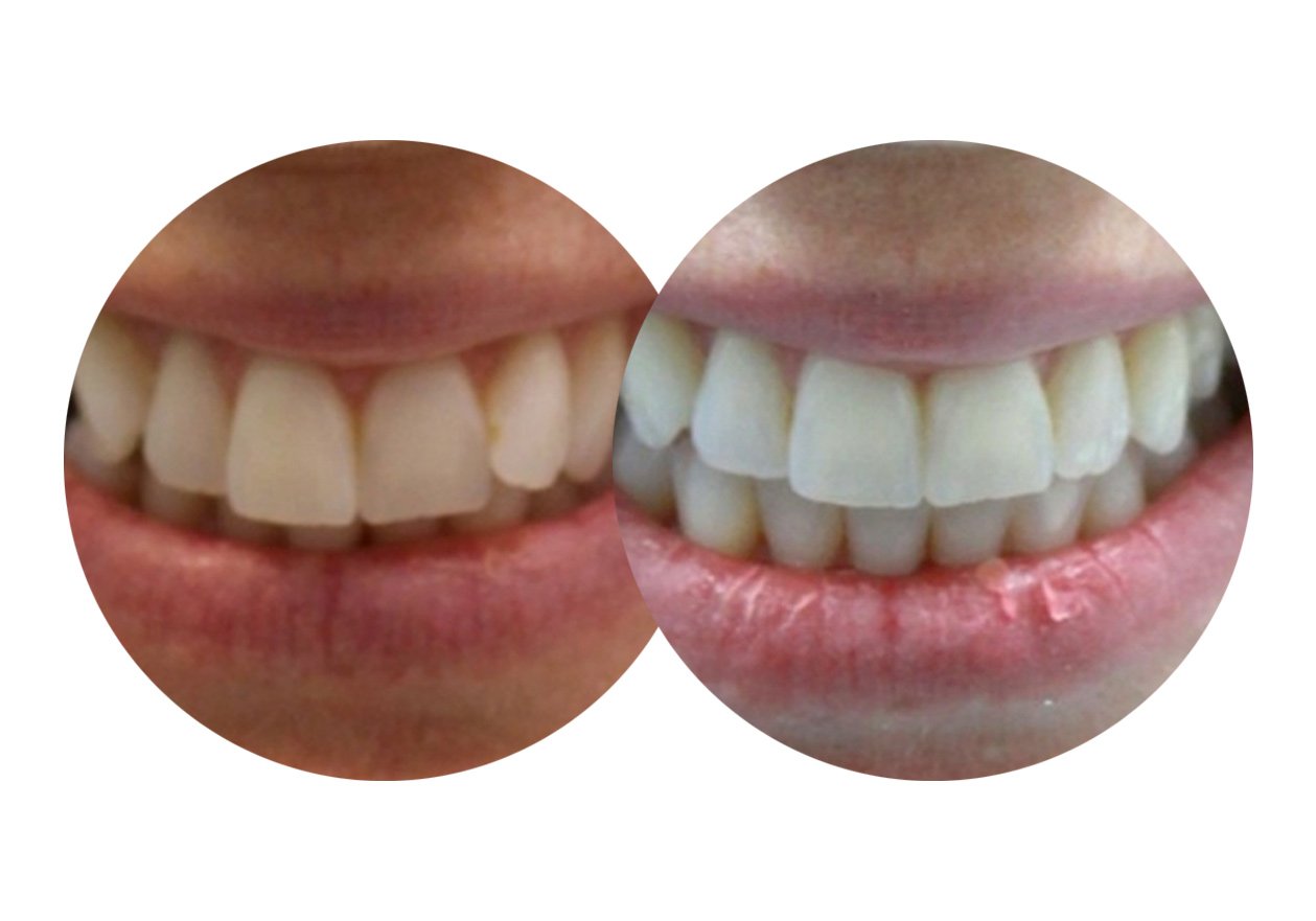 Cosmetic Dentist In Westpark Bakersfield California Calif CA Cosmetic Dentist In Westpark Bakersfield California Calif CA
