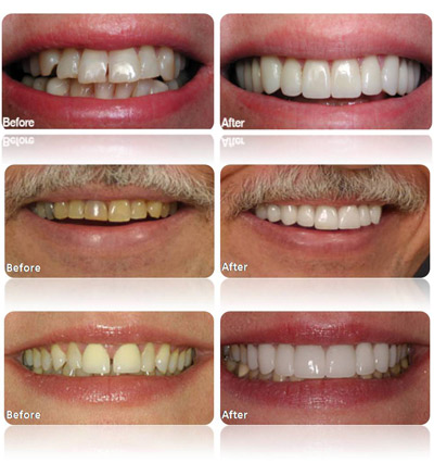 Cosmetic Dentist In Westshore Tampa Florida Fla FL Cosmetic Dentist In Westshore Tampa Florida Fla FL