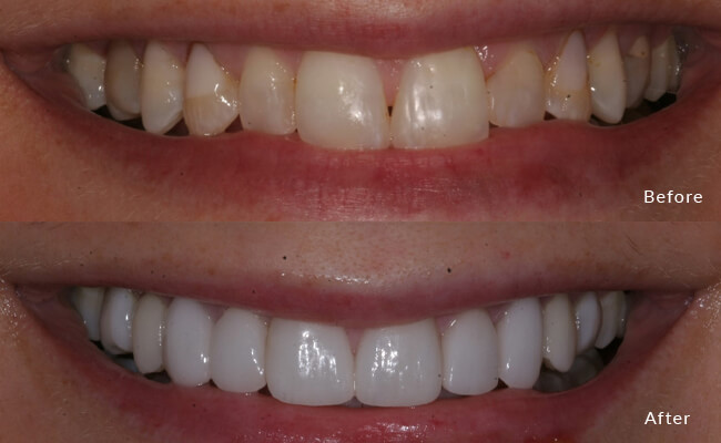 Cosmetic Dentist In Willy Street Williamson Marquette Madison Wisconsin Wis WI