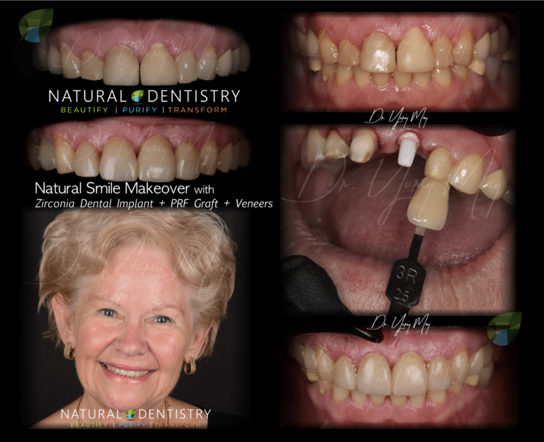 Top Cosmetic Dentist in Greendale Top Cosmetic Dentist in Greendale